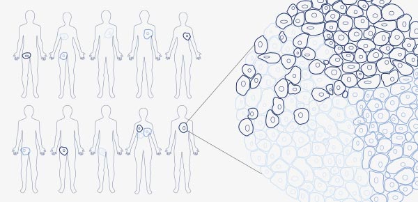 AACR 2016