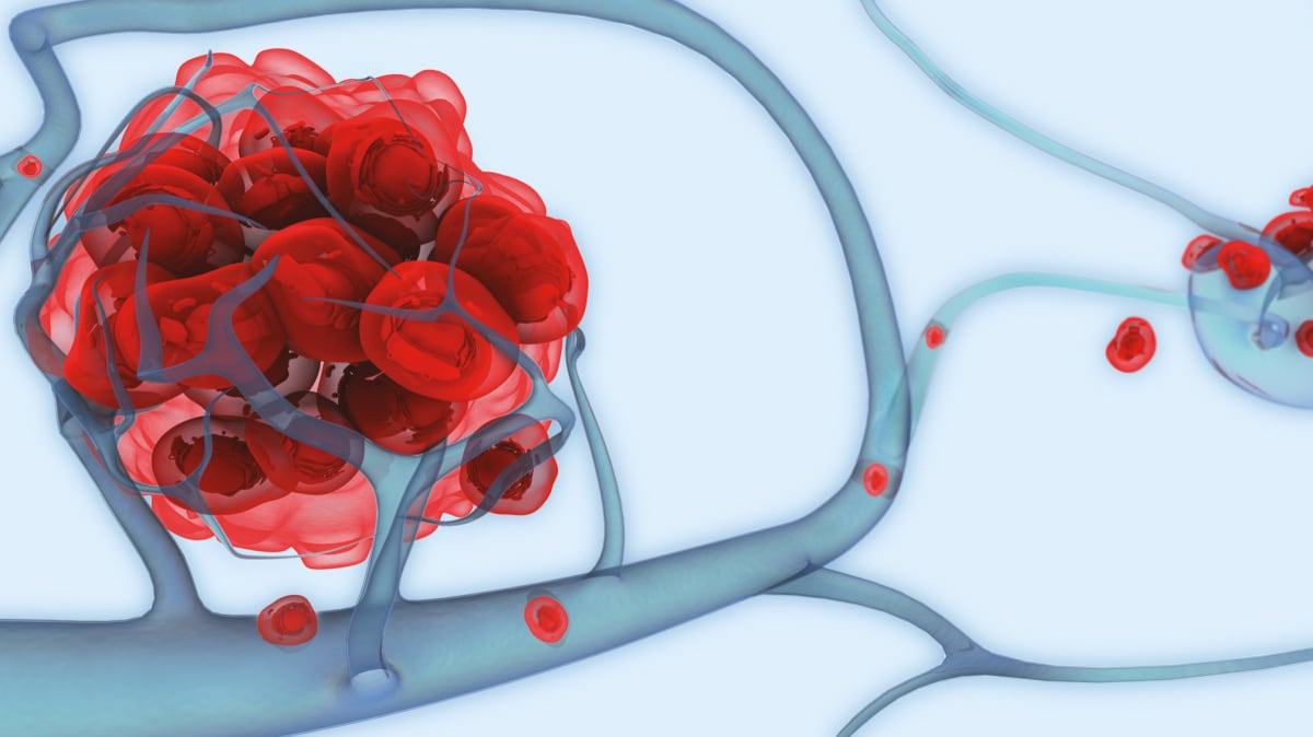 New momentum for harmonizing TMB results