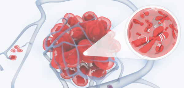 Biological parameters involved in EEC tumor progression